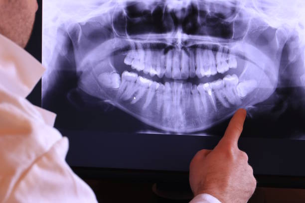 Best Tooth Infection Emergency Dentist  in Pierre Part, LA