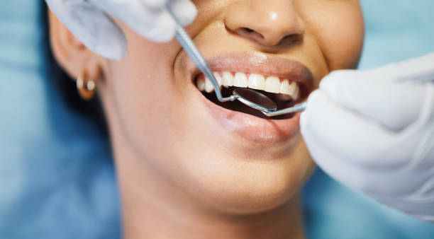 Tooth Infection Emergency Dentist in LA