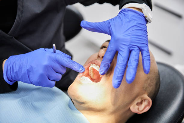 Best Dentist for Tooth Abscess  in Pierre Part, LA